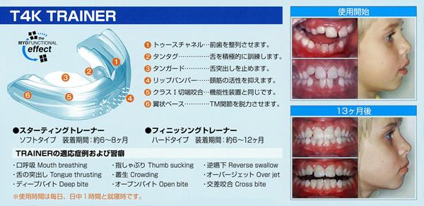 小児矯正｜抜かない矯正 T4K ムーシールド バイオブロック｜千葉県大網 